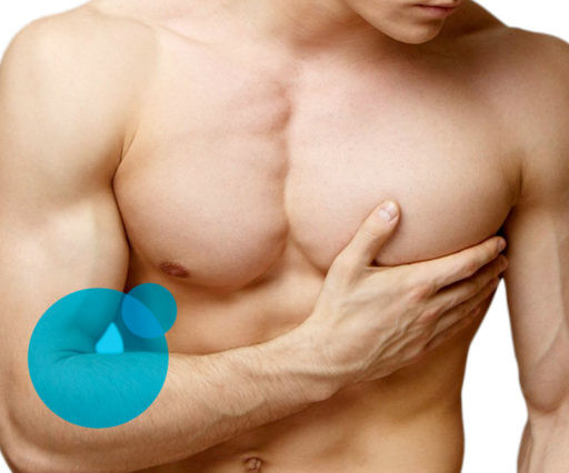 Ginecomastia Uomo - Miglior chirurgo