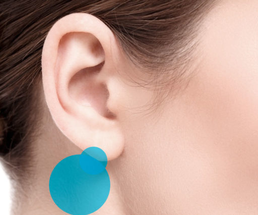 Otoplastica intervento