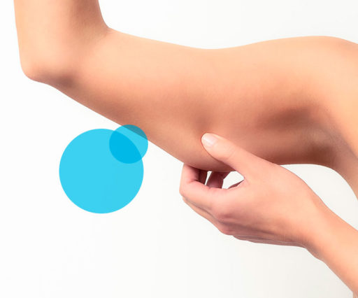 Lifting braccia - Chirurgo Napoli Arturo Amoroso