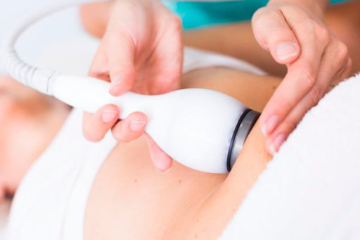 Laserlisi, la liposuzione celere