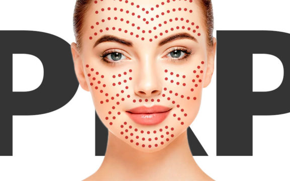 Tecnica PRP per il viso. Plasma ricco di piastrine