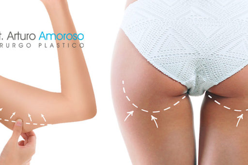 Mesoterapia: cos’è, a cosa serve