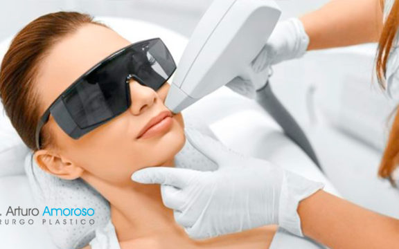 Laser a diodo per epilazione, la nuova tecnologia estetica per eliminare i peli superflui