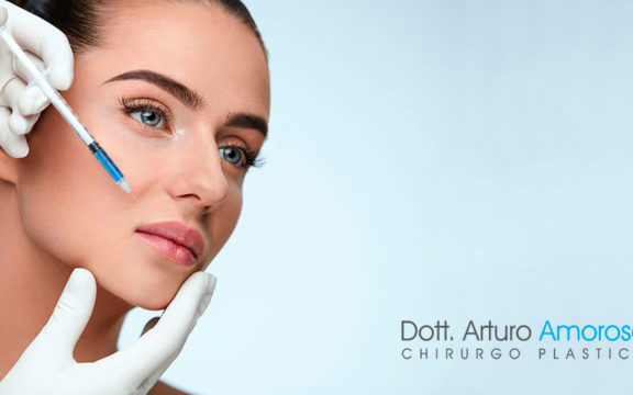 capillari rotti dopo filler
