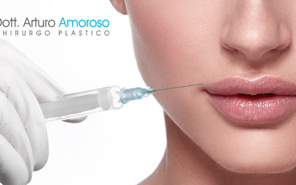 Filler labbra: come funziona