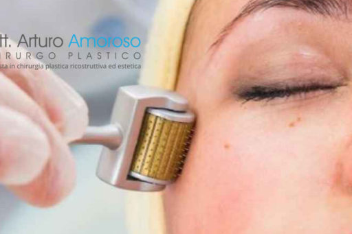 Trattamento needling per ringiovanire il volto