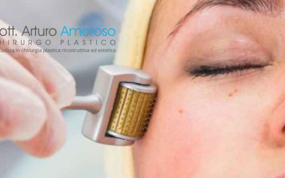 Trattamento needling per ringiovanire il volto