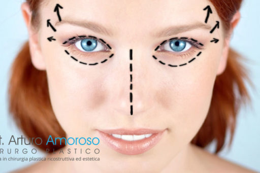 Blefaroplastica e lifting sopracciglio