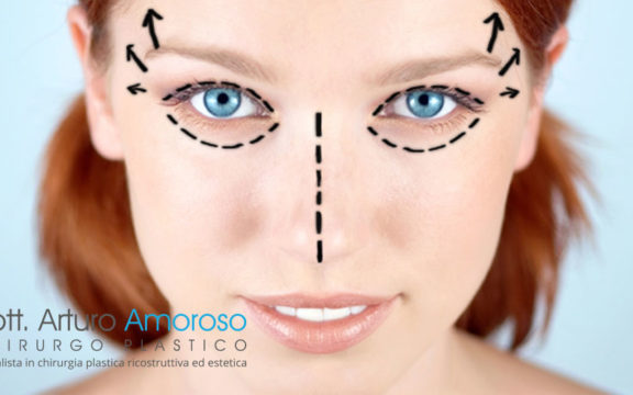 Blefaroplastica e lifting sopracciglio
