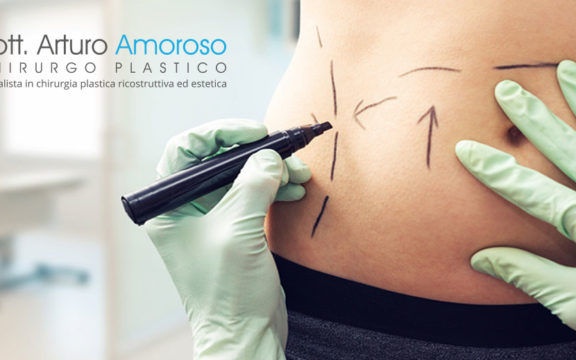 Liposcultura: cos’è e a chi si rivolge