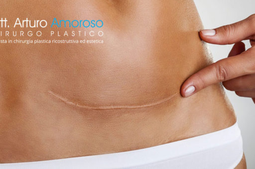 Come ridurre le cicatrici