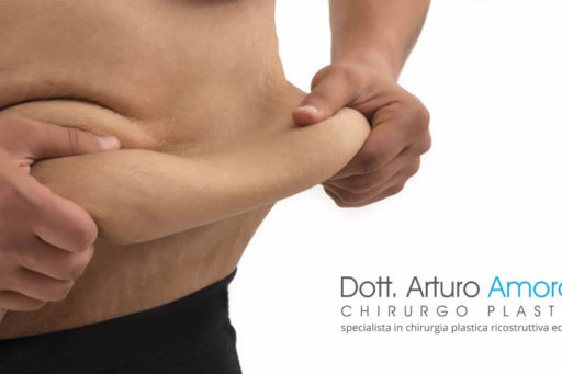 Chirurgia post trattamento bariatrico