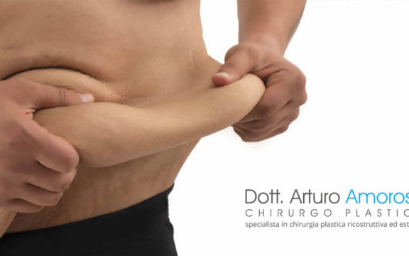 Chirurgia post trattamento bariatrico