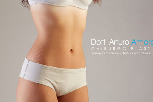 Peeling chimico contro le smagliature