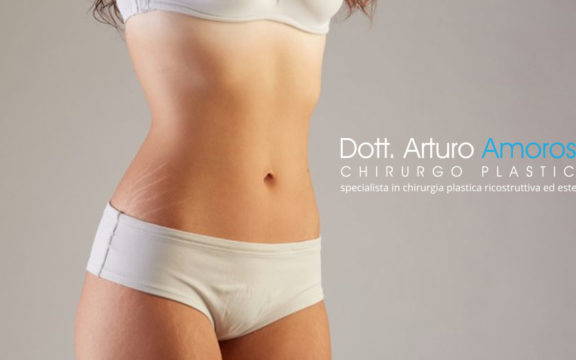 Peeling chimico contro le smagliature