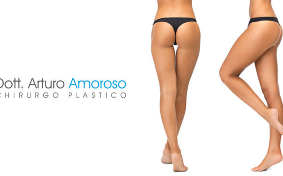 Gluteoplastica Napoli: la chirurgia estetica dei glutei