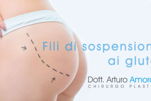 Fili di sospensione glutei:cosa sono?