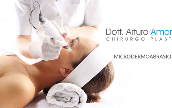 Microdermoabrasione: cos’è? come funziona? benefici e risultati