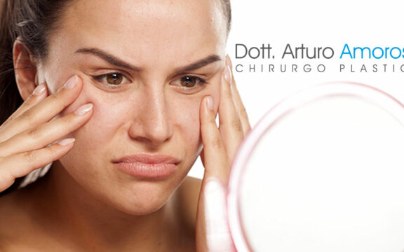 Eliminare le borse sotto gli occhi