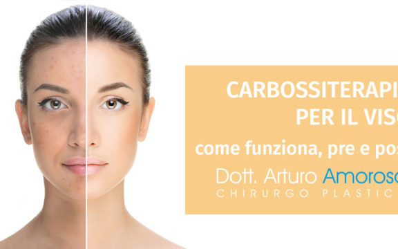 Carbossiterapia per il viso