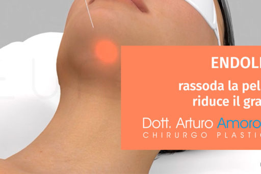 Endolift: rassoda la pelle sciogliendo il grasso