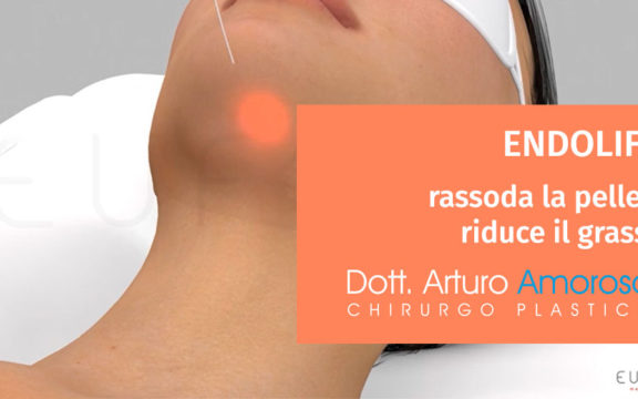 Endolift: rassoda la pelle sciogliendo il grasso