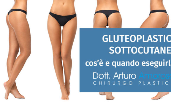 Gluteoplastica sottomuscolare: cos’è e quando eseguirla