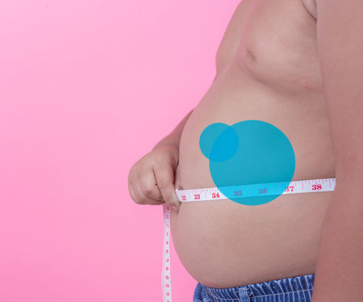 Il palloncino intragastrico Allurion – Tutto quello che c’è da sapere