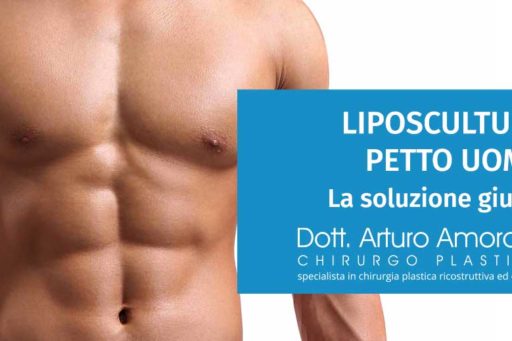 Liposcultura petto uomo: la soluzione che stai cercando