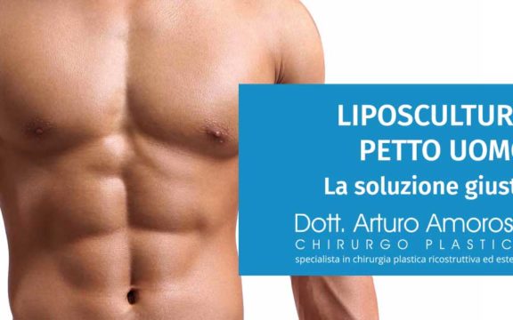 Liposcultura petto uomo: la soluzione che stai cercando