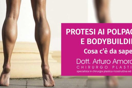 Protesi ai polpacci e bodybuilding: tutto quello che devi sapere