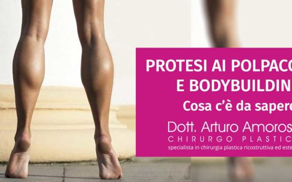Protesi ai polpacci e bodybuilding: tutto quello che devi sapere