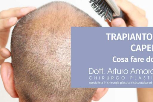 Cosa fare dopo il trapianto di capelli