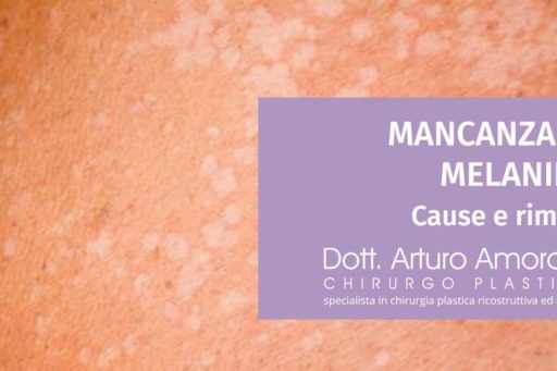 Mancanza di melanina: cause e rimedi