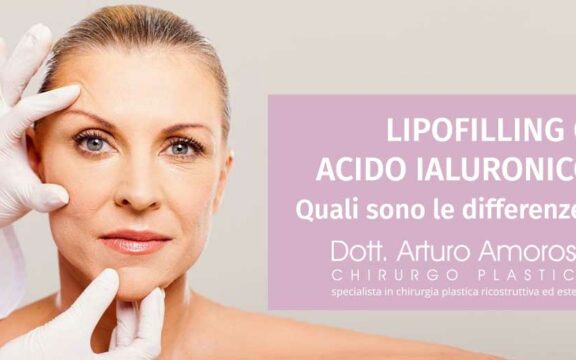 Differenze tra lipofilling e acido ialuronico