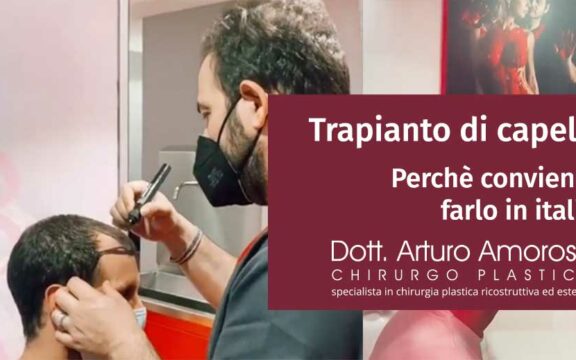 Perché conviene fare il trapianto di capelli in Italia