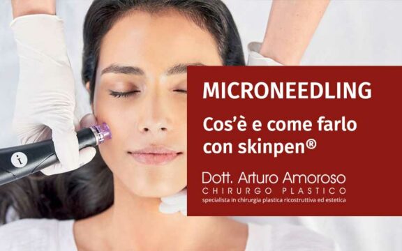Microneedling con SkinPen
