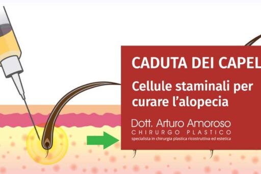 Cellule staminali per capelli per curare l’alopecia