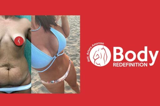 Body Redefinition 4D