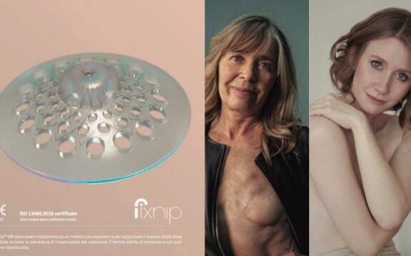 Fix Nip protesi per la ricostruzione di areola e capezzolo