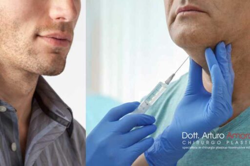 Come avere una mandibola squadrata o a diamante perfetta: Diamond Lift maschile