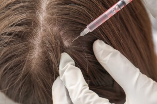 Super PRP: L’Innovazione nella Medicina Rigenerativa