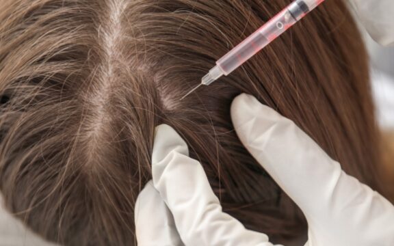 Super PRP: L’Innovazione nella Medicina Rigenerativa