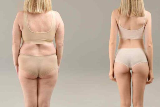 Cos’è il nanofat grafting e quanto dura?