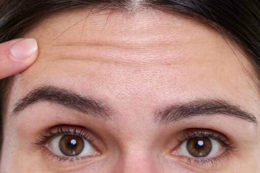 Frontoplastica per rimodellare la fronte