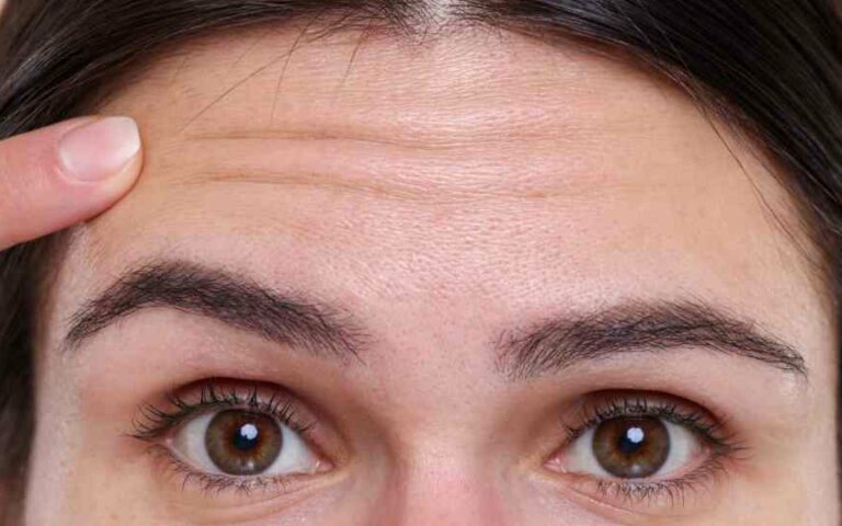 Frontoplastica per rimodellare la fronte