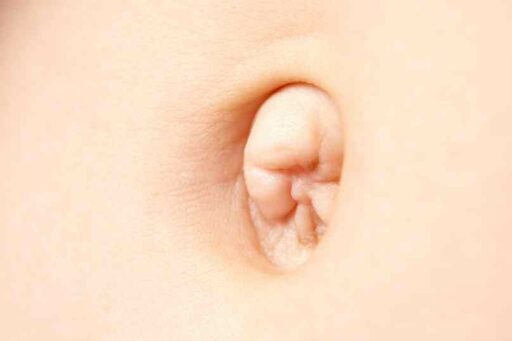 Come modificare l’ombelico e quanto costa?