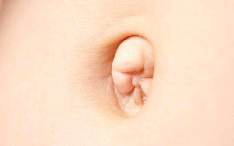 Come modificare l’ombelico e quanto costa?