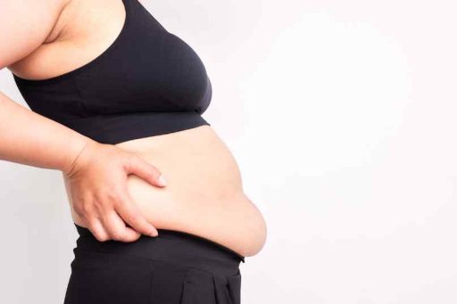 addominoplastica napoli - Addominoplastica: elimina la diastasi addominale e la pelle in eccesso