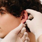 otoplastica napoli - Otoplastica: correzione delle orecchie a sventola